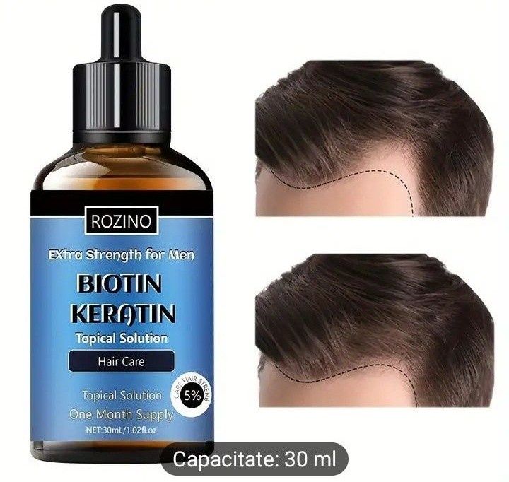 Soluție impotrica căderii parului (eficienta 100%)cu biotina si kerati