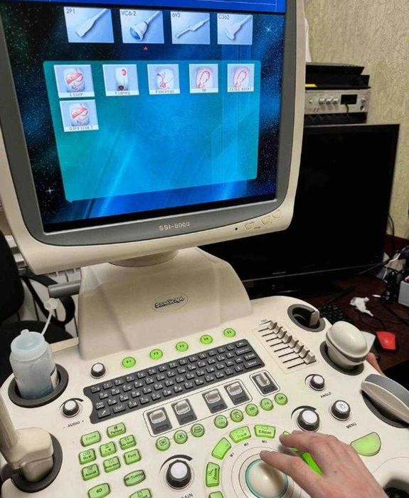 УЗИ аппарат SonoScape SSI8000