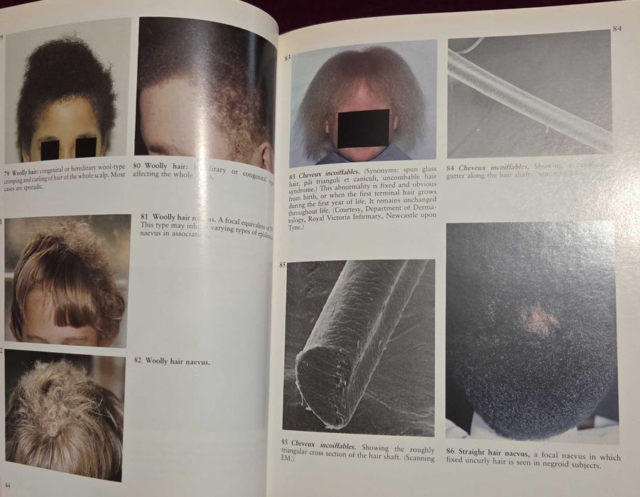 A Colour Atlas of the Hair, Scalp and Nails