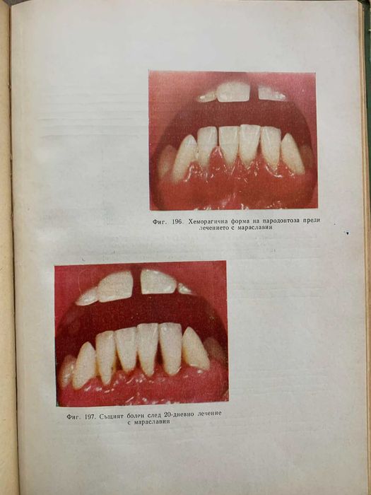 Терапевтична стоматология-Димитър Свраков