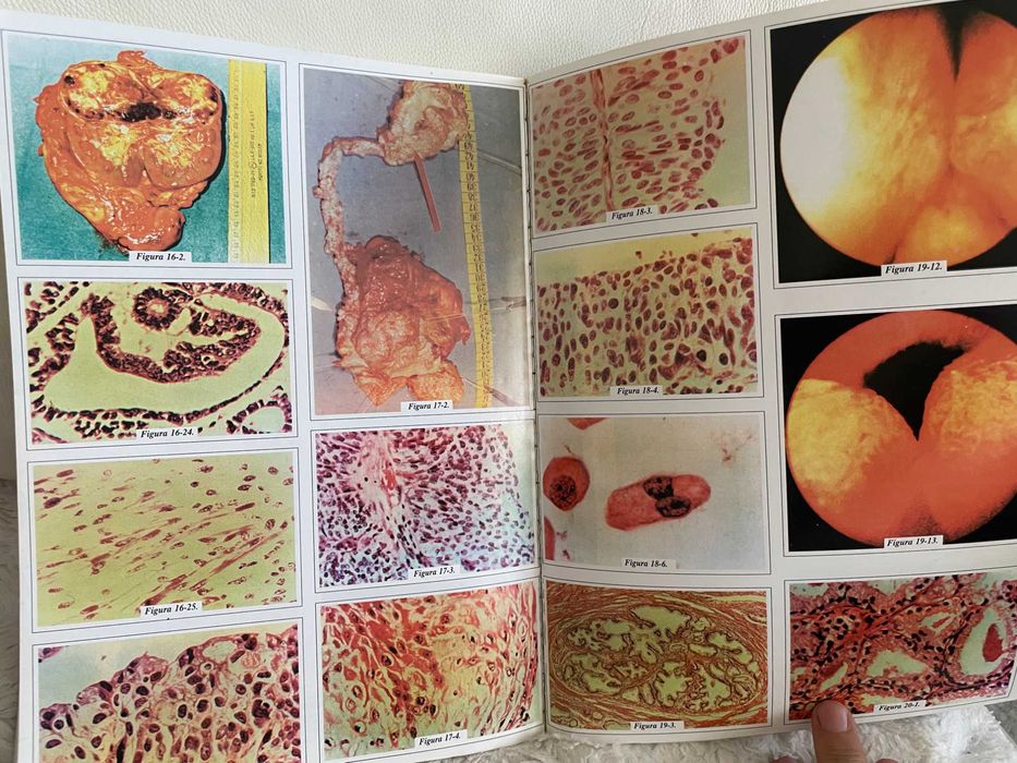 Atlas/tratat Medicina Interna Cecil Urologie Sinescu rezidentiat NOU