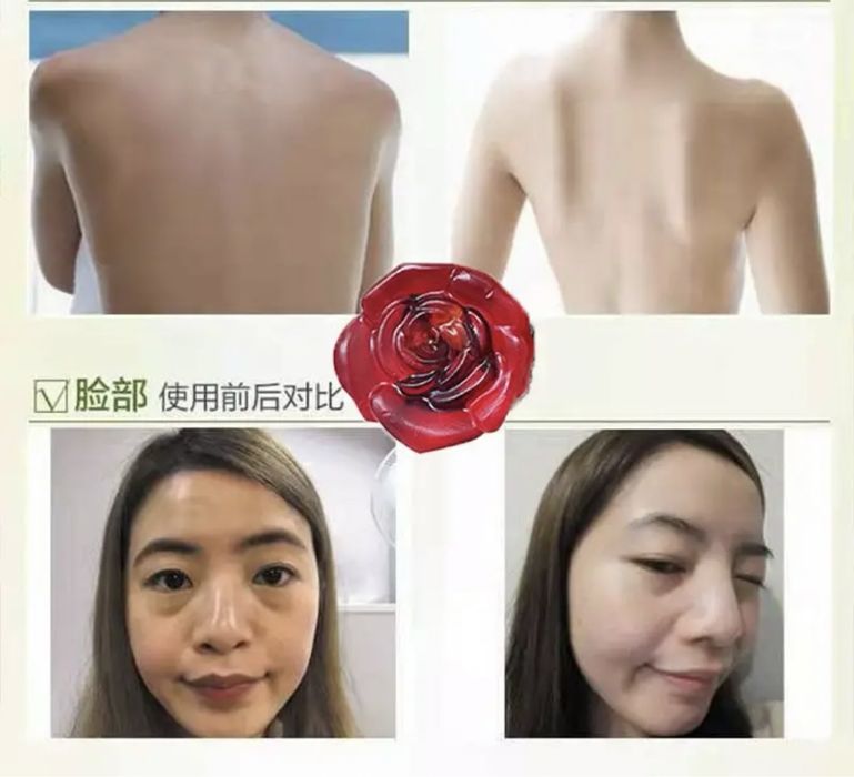 Отбеливающий мыло hmot