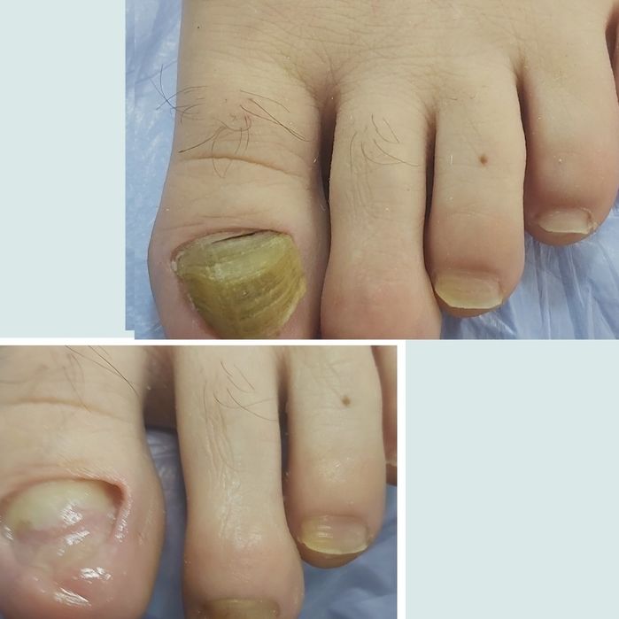 Pedichiura Kart Oradea