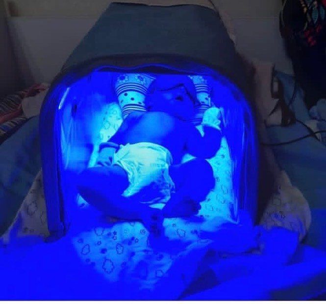 Фотолапма От Желтушки Алматы