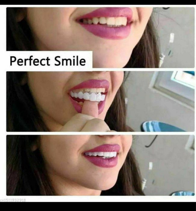 виниры для зубов белые съемные