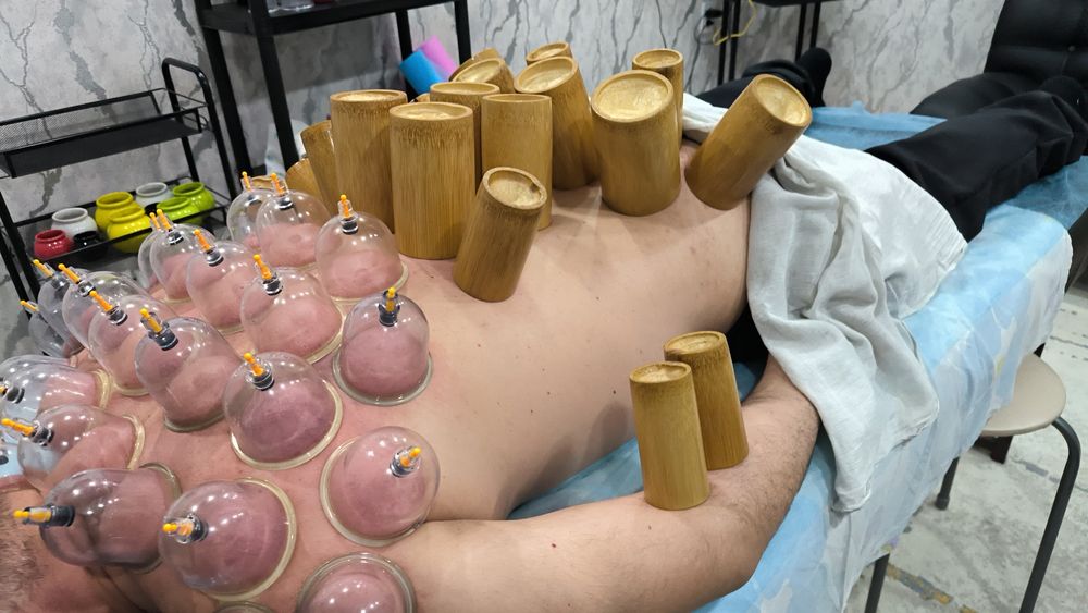 Массаж профессиональный хиджама