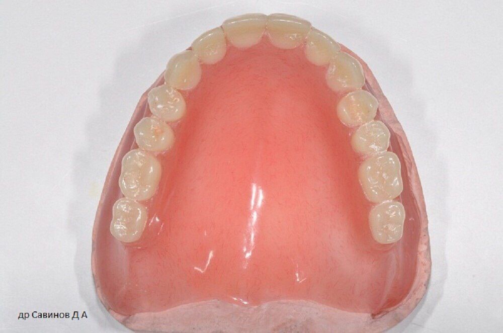Сьемные зубные протезы