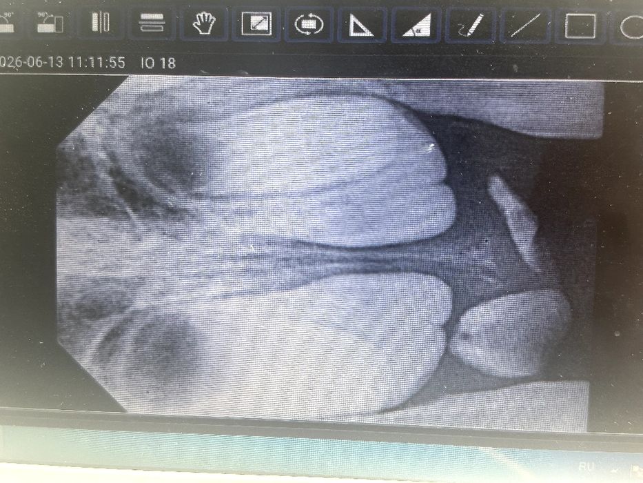 Dental rentgen ishlatilmagan yangi