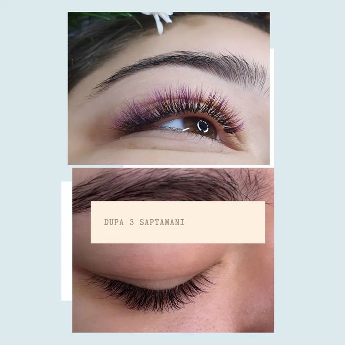 Extensii de gene Galați