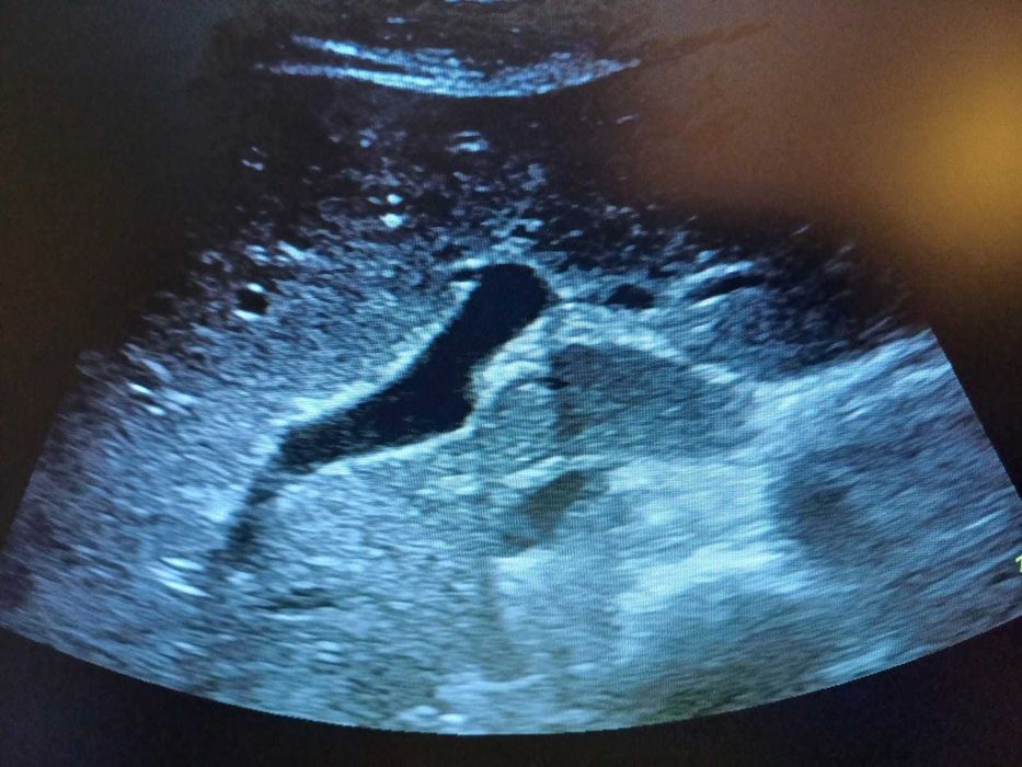 Ecograf stationar GE Logiq F6 cu trei sonde in stare excelenta