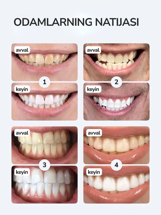 Оригинал Hismile профессиональный отбеливатель зубов