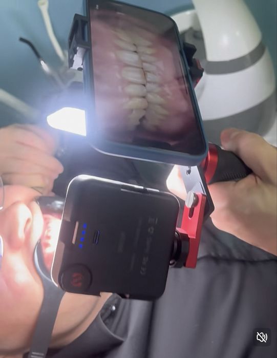 MKT-016 для дентальной фотографии