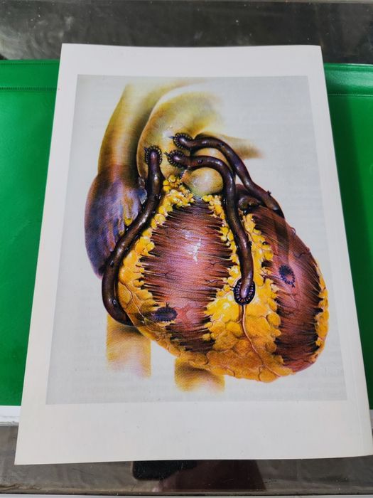 Хобито ми бе хирургията Йовчо Б. Топалов