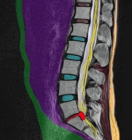 НУГА БЕСТ N5 -кроват кумуртқа поғона чурраси учун ва қон айланиши учун