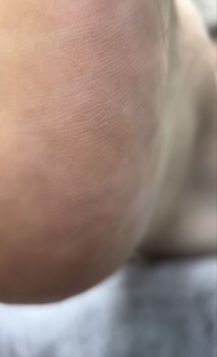 Услуги  подолога