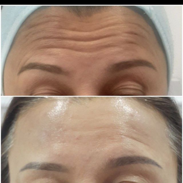 Косметология для женщин