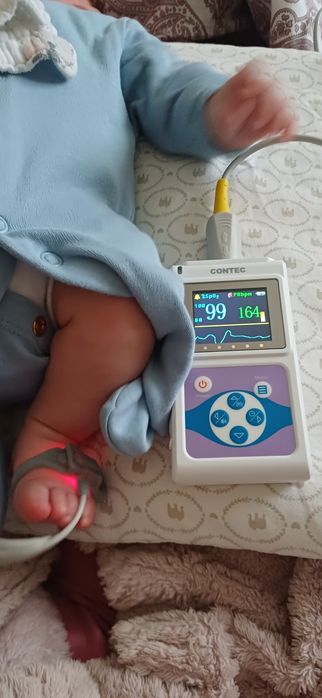 Pulsoximetru in stare perfecta de functionare