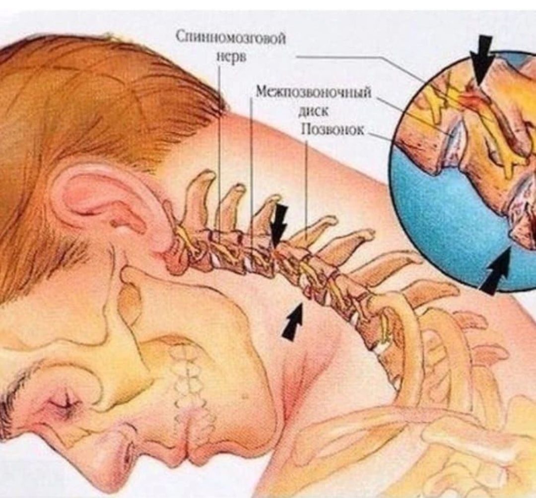 Как можно снять головокружение