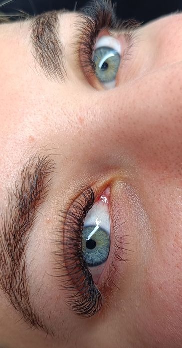 Gene fir cu fir tehnica one by one