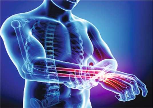 Бандаж из неопрена для фиксации лучезапястного сустава