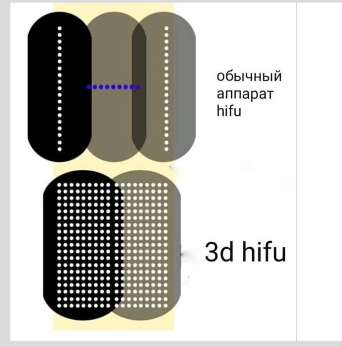 Продам аппарат Smas hifu 3d
