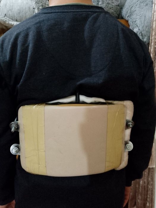 Korset xolati ideal 2 oy ishlatilgan umurtqa uchun