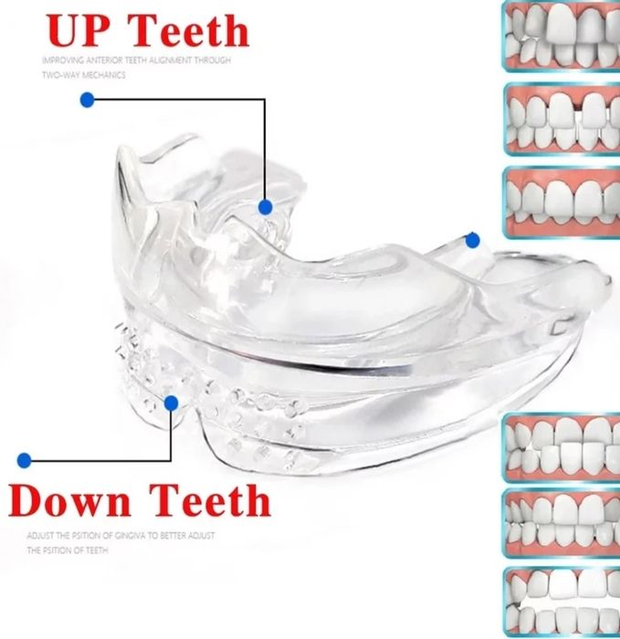 Промо-Ортодонтски коректор,шини,алайнер на зъби брекети зъбен фиксатор