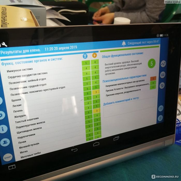 Rofes апараты денсаулық тексеруге арналған