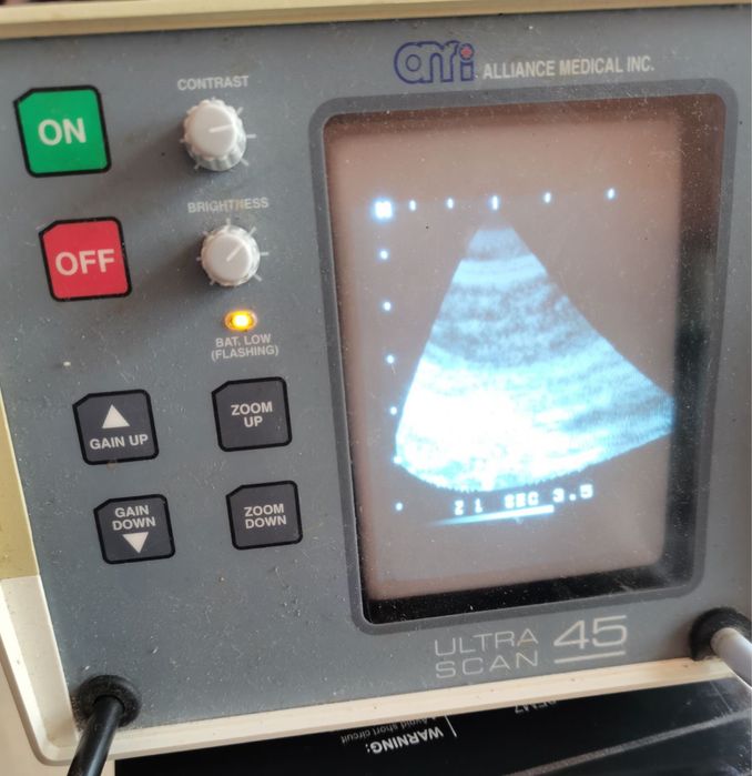 ехограф Ultra Scan 45