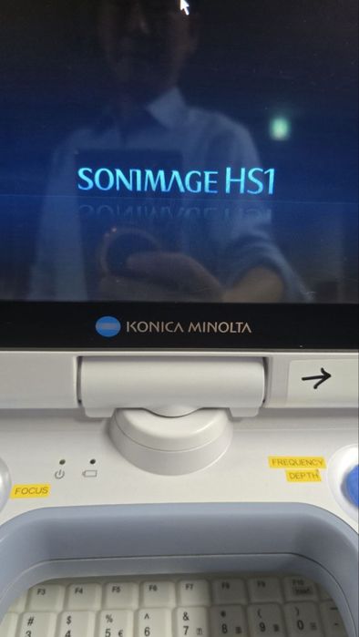 Konica Minolta Sonimage HS1 portativniy UZI apparat