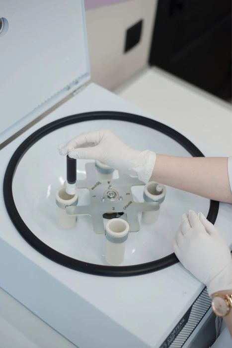 Cortexil PRP центрифуга для плазмолифтинга