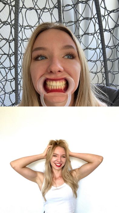 Бизнес с ДОХОДОМ ОТ МИЛЛИОНА в месяц отбеливание зубов