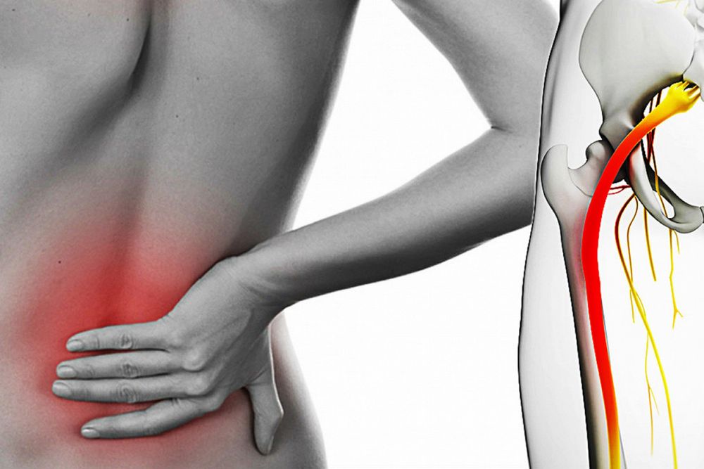 Седалищный нерв, гайморит лечение, хиджама