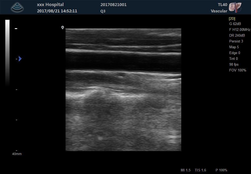 Zoncare-Q3 - Цифровой стационарный УЗИ аппарат с цветным