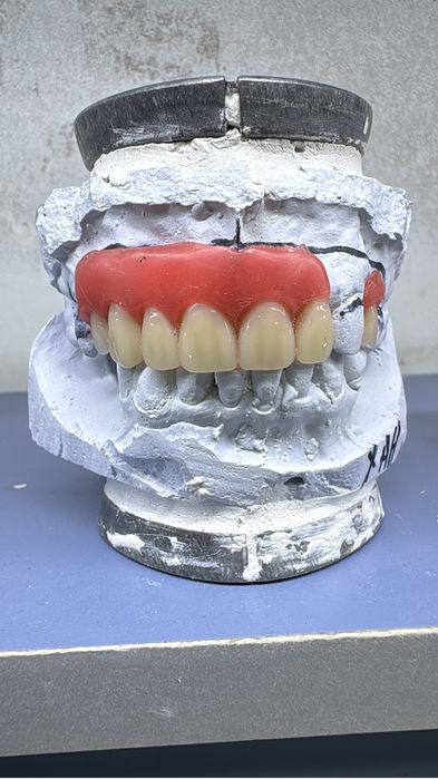 Протез жасаймыз.