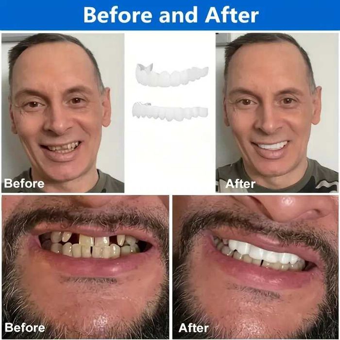 Proteze fatete dentare 2 seturi dinți superiori și inferiori pentru dinti ortodontici temporari dinti falsii.  Crema Scrub corp cu sare de mare 300g.