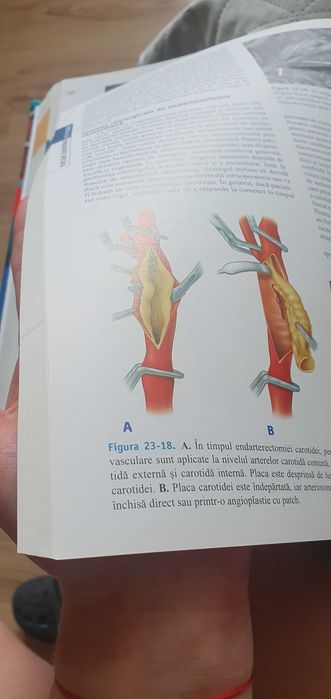 Schwartz Principiile Chirurgiei