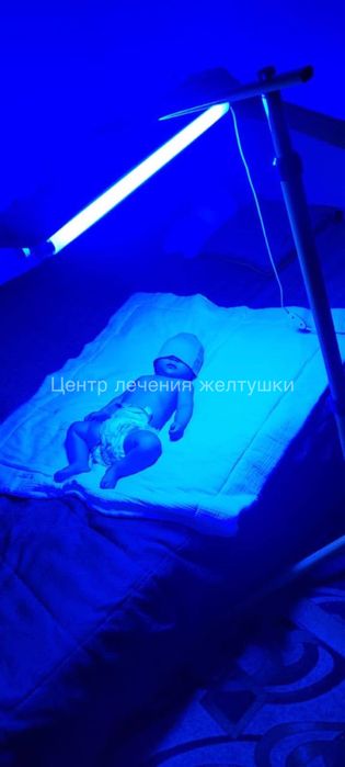 Фотолампа для новорожденных