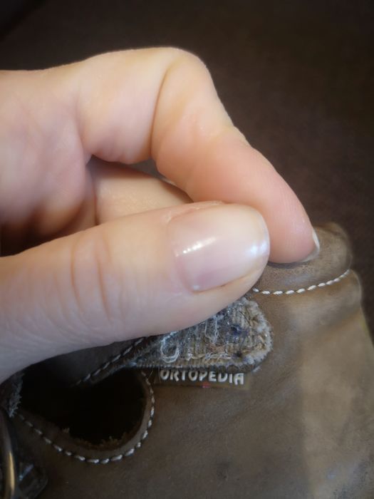 Ортопедическая обувь