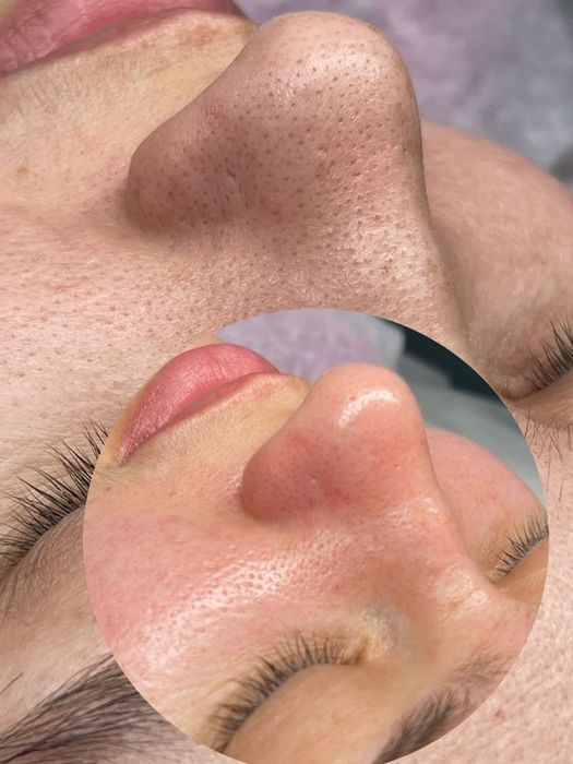 Косметолог. Депиляция на дому.