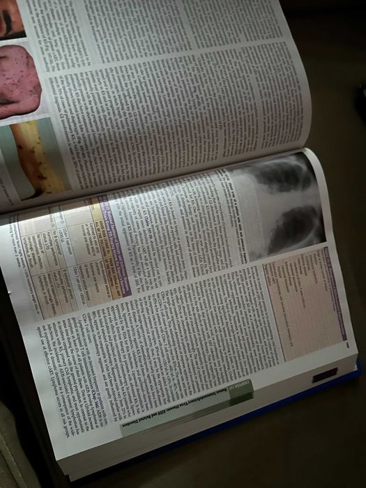 Tratat Harrison in engleza editia 20