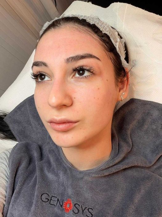 Tratamente cosmetice profesionale, (stilizare gene, epilare) - Facial și corp - anti-aging reale