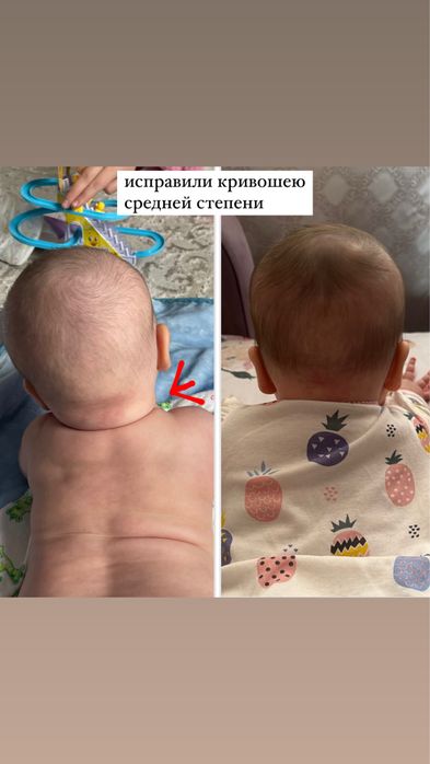 Детский массажист педиатр Алматы