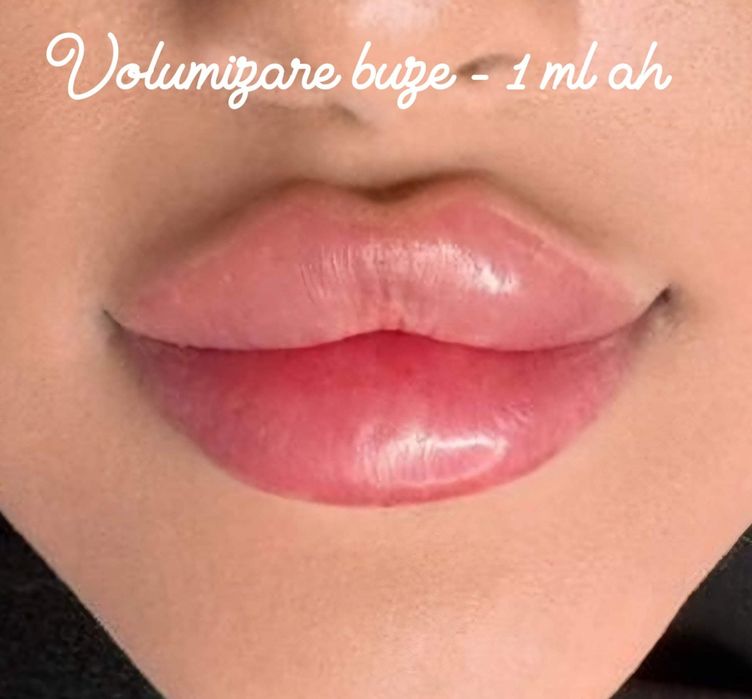 Tatuaje cosmetice Volumizare buze  - Arad