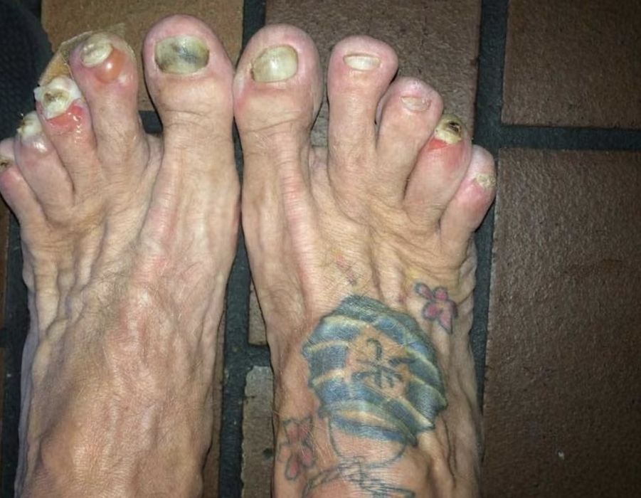 Feet peaks foarte frumoase