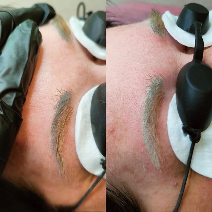 Удаление татуажа, тату