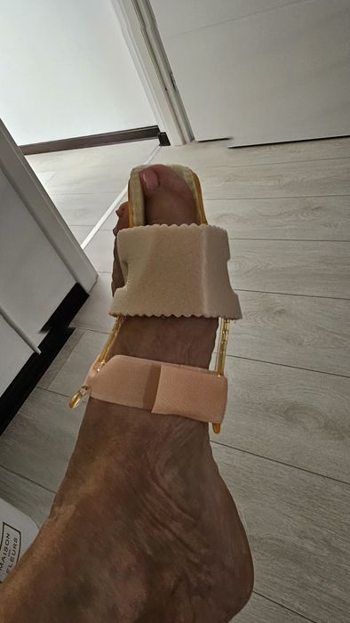 Orteze de noapte pentru monturi