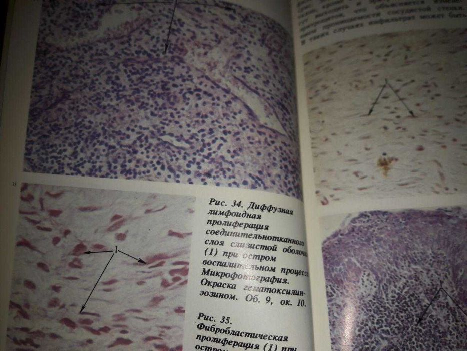 Атлас заболеваний слизистой оболочки рта.