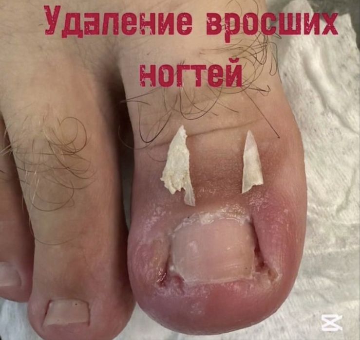 Педикюр на выезд