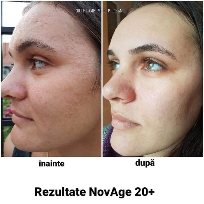 Set  creme cu celule STEM din plante